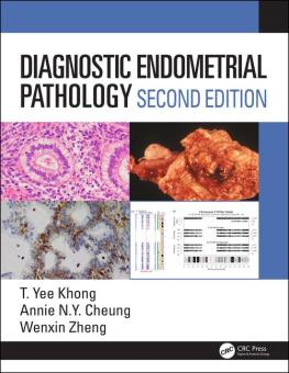 Diagnostic Endometrial Pathology 