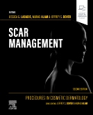 Scar Management 