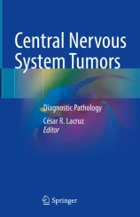 Central Nervous System Tumors 