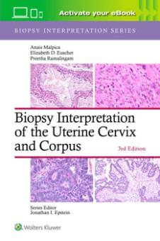 Biopsy Interpretation of the Uterine Cervix and Corpus 