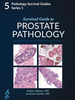 Survival Guide to Prostate Pathology 