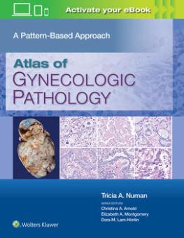 Atlas of Gynecologic Surgical Pathology 