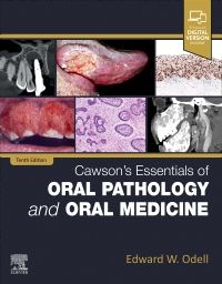 Cawson's Essentials of Oral Pathology and Oral Medicine 