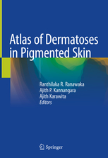Atlas of Dermatoses in Pigmented Skin 