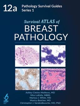 Survival ATLAS of Breast Pathology 