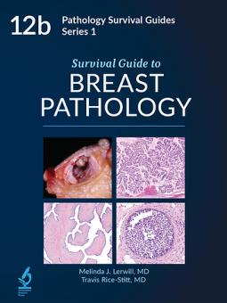 Survival Guide to Breast Pathology 