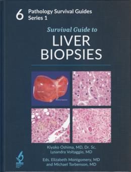Survival Guide to Liver Biopsies 