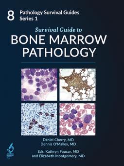 Survival Guide to Bone Marrow Pathology 