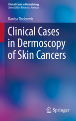 Clinical Cases in Dermoscopy of Skin Cancers 