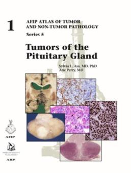 Pituitary Tumors 