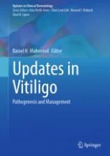 Updates in Vitiligo 