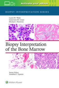Biopsy Interpretation Series 