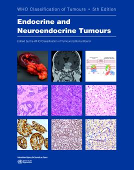 WHO Classification of Tumours: Endocrine and Neuroendocrine Tumours 