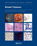 WHO Classification of Tumours: Breast Tumours 