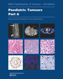 WHO Classification of Tumours: Paediatric Tumours 