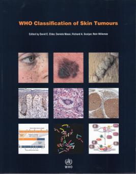 WHO Classification of Skin Tumours 