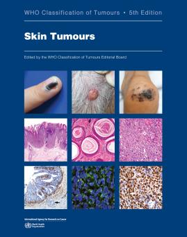 WHO Classification of Tumours: Skin Tumours 