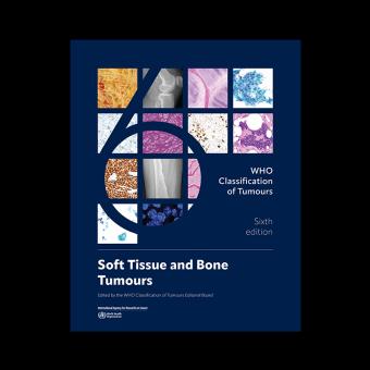 WHO Classification of Tumours: Soft Tissue and Bone Tumours 