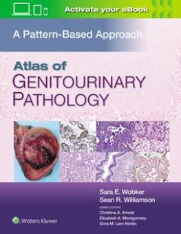 Atlas of Genitourinary Pathology 